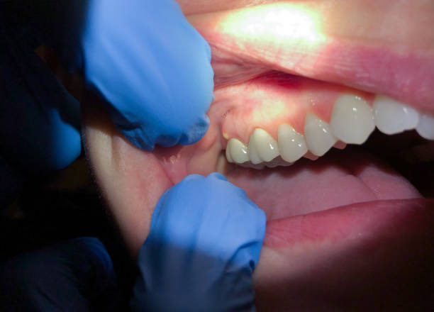 Best Broken Tooth Emergency  in Centre, AL